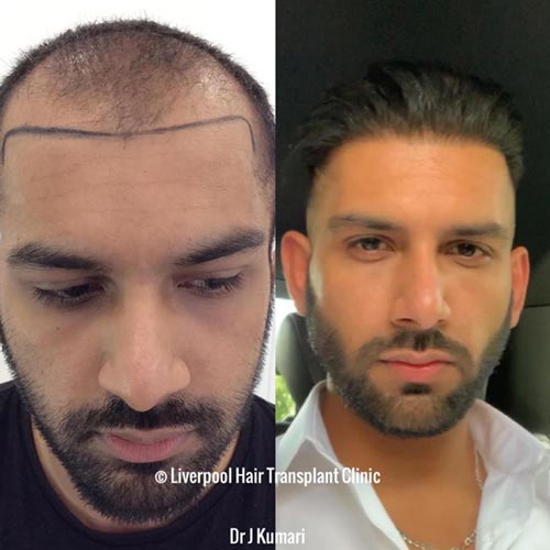 Testim Waqas